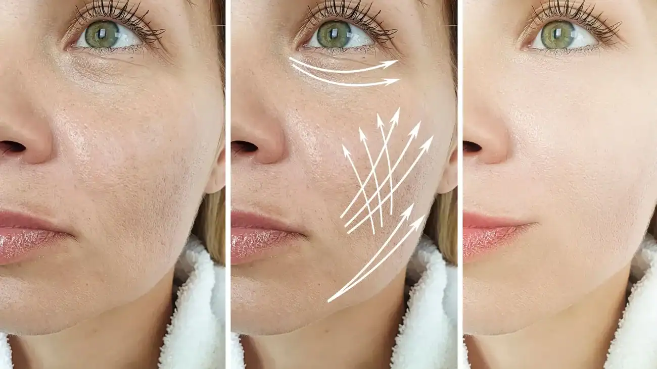Can One Treatment Really Tackle More Than One Skin Concern Melksham?
