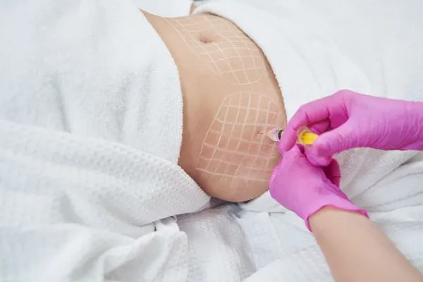 image of fat dissolving injections on love handles to help combat weight gain Melksham
