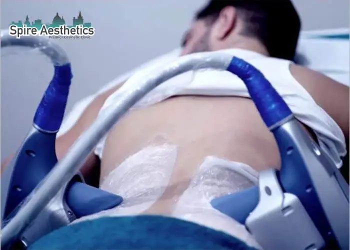 Man having fat freezing treatment done on love handles before a competitions Melksham to create a sculpted look.