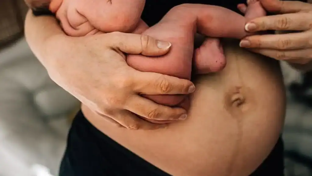 Why Is My Stomach Still Big After Pregnancy Melksham?