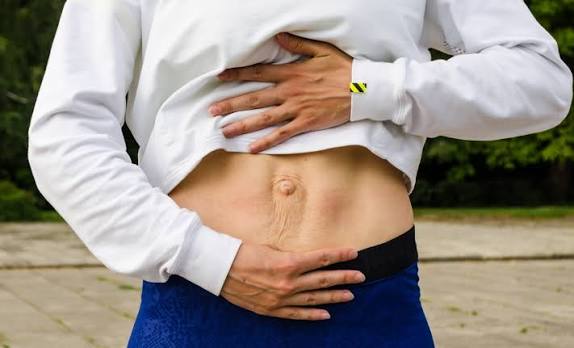 When Could Diastasis Recti Be the Missing Piece of the Puzzle Melksham?